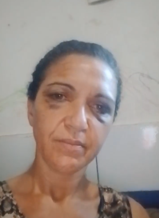 Mulher denuncia tentativa de feminicídio em Ituberá e relata agressões
