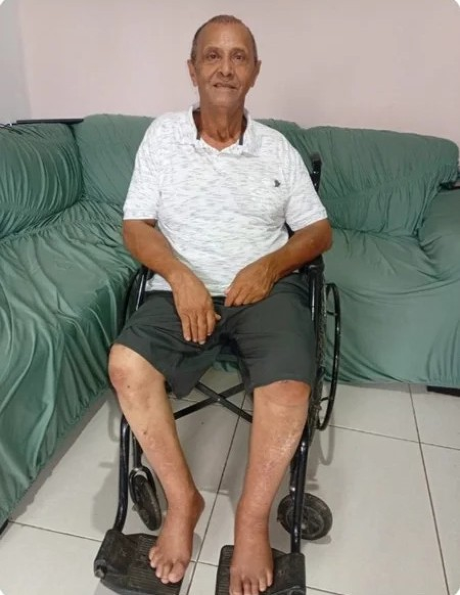 Amigos e familiares de morador de Itamari fazem campanha para compra de cadeira de rodas motorizada