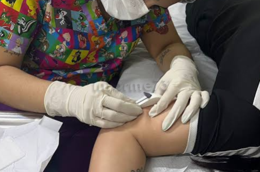 Mulheres de Gandu já podem ter acesso gratuito ao Implanon nas unidades de saúde